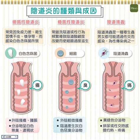 私密處生瘡